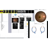 VisionPACS 眼科系统